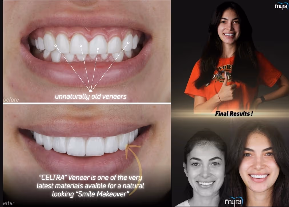 Cosmetic Dentistry Transformations