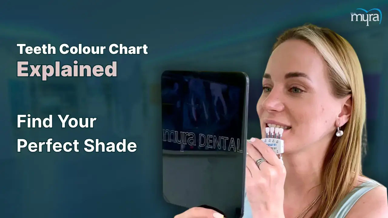 Teeth-colour-chart