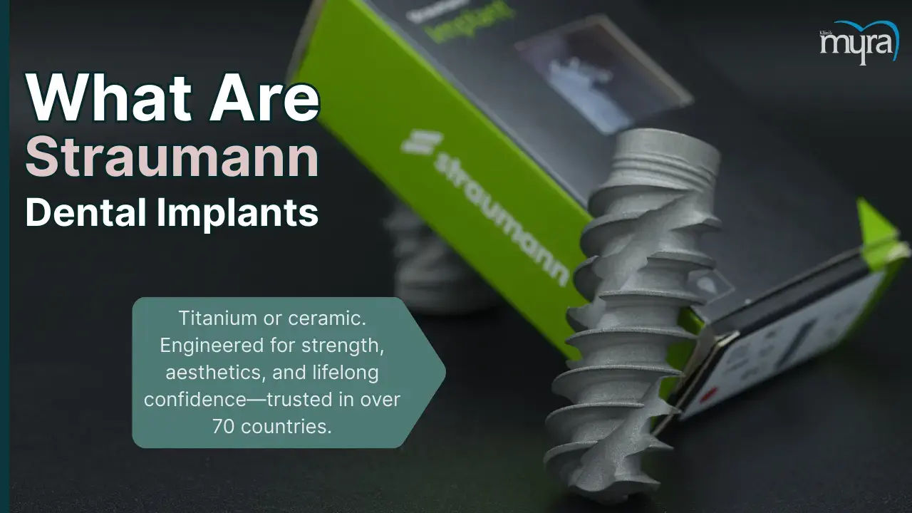 Straumann Implants