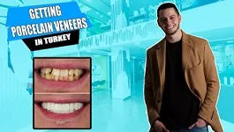 Getting-porcelain-veneers-in-Turkey